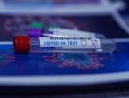 Predstavljen test koji razlikuje gripu od infekcije COVID-19