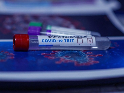 Predstavljen test koji razlikuje gripu od infekcije COVID-19