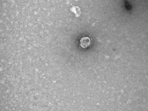 Ruski znanstvenici dešifrirali genom koronavirusa
