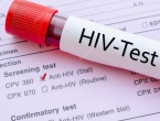 Znanstvenici pronašli prekidač za HIV?