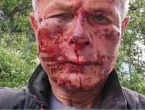Hrvatski povratnik u Konjicu brutalno pretučen