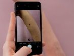 Stigla aplikacija koja može prepoznati kožne probleme poput madeža ili osipa