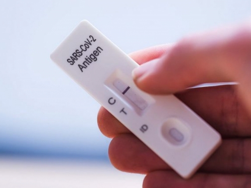 Hrvatska: S brzim antigenskim testom do covid potvrde; PCR lobij u problemima
