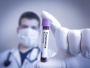 Moguće je biti zaražen, a da je PCR test negativan