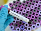 Novih pet slučajeva koronavirusa u Hrvatskoj