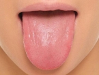 Promjena boje jezika otkrit će infekcije i nedostatak vitamina