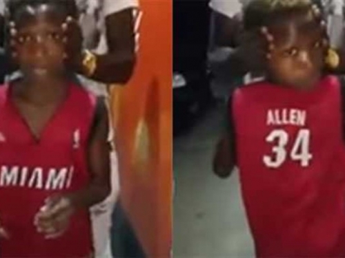 VIDEO: Ovaj dječak može okrenuti glavu za 180 stupnjeva
