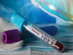 Sedam novih slučajeva koronavirusa u BiH