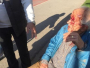 Migranti u Sarajevu brutalno pretukli i opljačkali starca