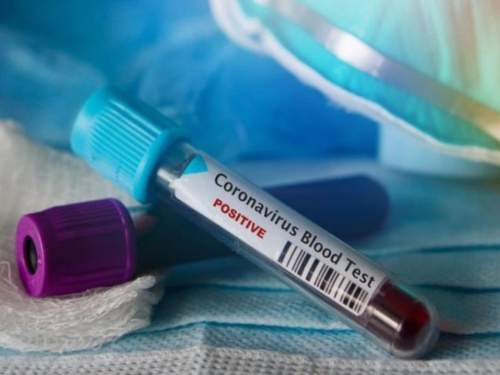 BiH nema reagense na testiranje koronavirusa