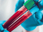 Znanstvenici otkrili recept za proizvodnju umjetne krvi