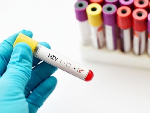 U FBiH u ovoj godini registrirano pet novih slučajeva zaraze HIV-om
