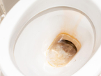 Žute mrlje nestat će iz WC školjke za 30 minuta, samo ulijte jedan običan sastojak iz kuhinje