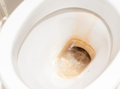 Žute mrlje nestat će iz WC školjke za 30 minuta, samo ulijte jedan običan sastojak iz kuhinje