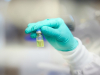 Jeftin lijek nudi nadu za okončanje epidemije HIV-a
