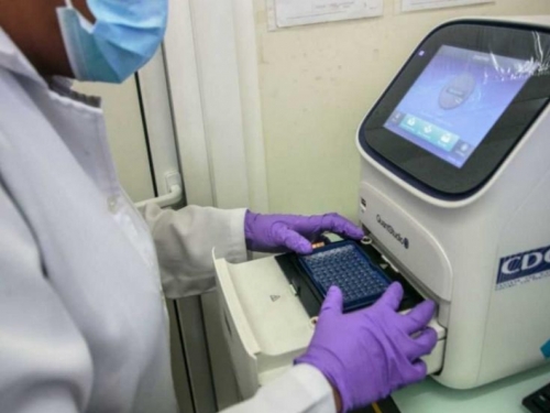 Nedostatak PCR testova u Bosni i Hercegovini