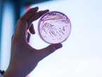 Stotinu Amerikanaca zaraženo E.coli, mogući “krivac” zelena salata