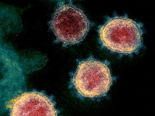 Guardian: Postoji više razloga zašto covid neće biti kao gripa