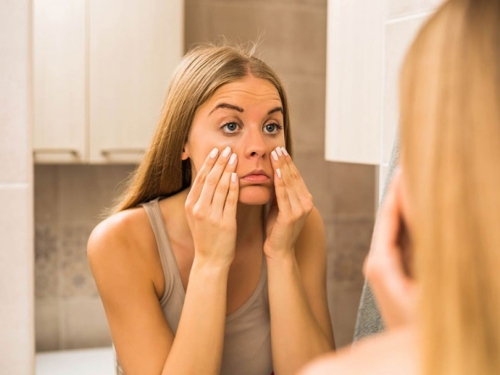 Dermatolozi: Ukinite jednu jutarnju naviku koja uzrokuje podočnjake