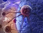 Mitovi o karcinomu u koje trebate prestati vjerovati