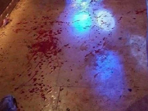 Sedmero ljudi izbodeno u kafiću u Slatini: “Ušao je s 2 noža i krenuo bosti”