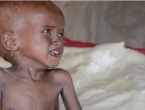 UN upozorio: U Jemenu je gotovo 8,5 milijuna ljudi gladno