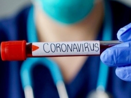 Novi Travnik: Koronavirusom zaražena jedna osoba