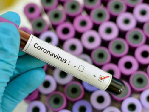 U Hrvatskoj 381 novi slučaj zaraze koronavirusom