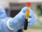 UK će testirati krvnu plazmu pacijenata koji su preboljeli covid-19