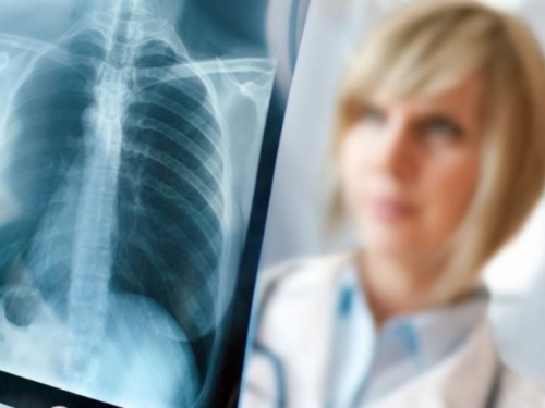 Hrvatska: Softver za očitavanje CT-a pluća uštedjet će radiolozima tisuće sati