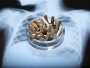 Kakve posljedice na zdravlje ostavlja pušenje samo jedne kutije cigareta dnevno?