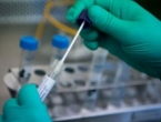Američka FDA odobrila prvi brzi test na koronavirus, rezultati za 45 minuta