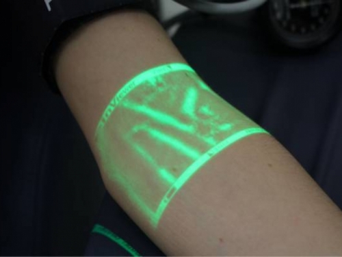 Ova tehnologija pokazuje medicinskim sestrama gdje su vene