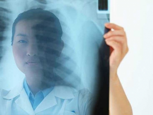 Zagađenje zraka i rak pluća kod nepušača
