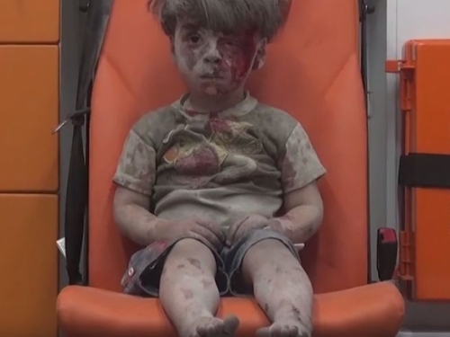 Ranjeni dječačić rasplakao svijet i postao novi simbol Alepa