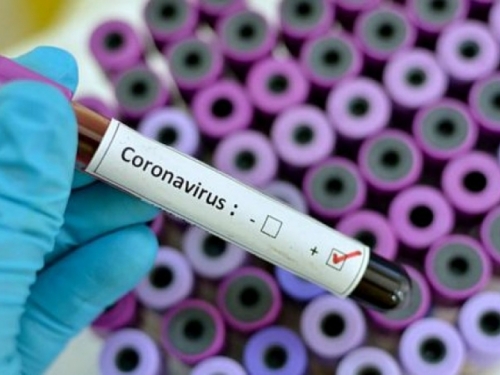 U Češkoj po prvi put više od 4.000 slučajeva koronavirusa u jednom danu
