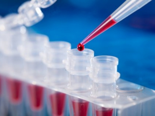 Njemačka prizna PCR testove Burkine Faso, ali ne i Bosne i Hercegovine