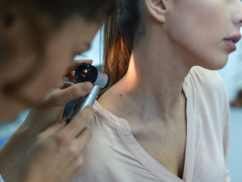 Imate bradavice? Evo što boja i oblik otkrivaju o tipu virusa i kada se morate javiti liječniku