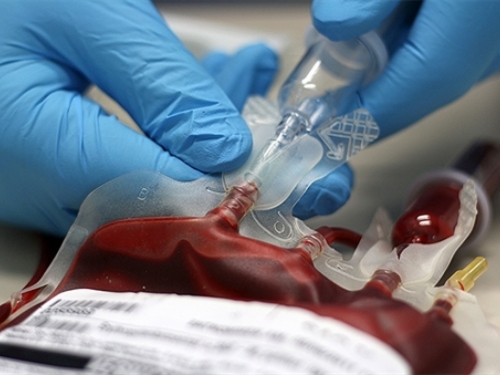 Faktori koji mogu ukazati da ti prijeti krvni ugrušak