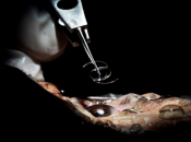 Liječnici u Londonu revolucionarnom injekcijom gela vraćaju vid