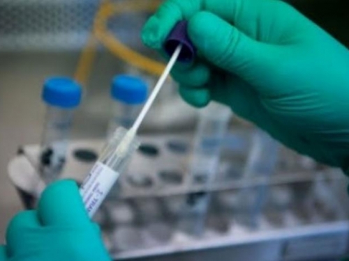 Odobren novi test za koronavirus za cijelu Europu - 99% pouzdan