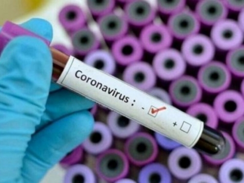 122 novozaražena koronavirusom u Federaciji