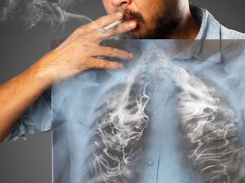 Pluća se ‘magično’ sama oporave nakon prestanka pušenja