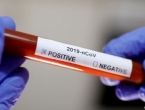 ​U FBiH 463 novozaraženih, 672 oporavljenih od koronavirusa