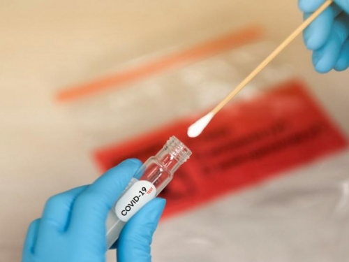 Brzi testovi na koronavirus - Koliko koštaju i jesu li pouzdani?