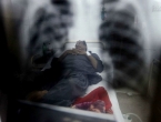 WHO: Prošle godine od tuberkuloze oboljelo 10 milijuna ljudi