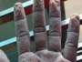 Goran Čerkez fotografijom ruke medicinske sestre poslao snažnu poruku građanima