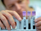 Znanstvenici razvili desetominutni test za otkrivanje raka