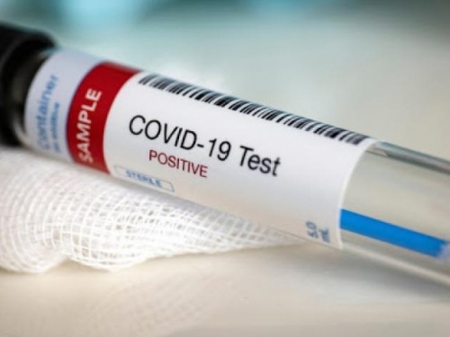 Središnja Bosna napokon dobila laboratorij za testiranje na koronavirus