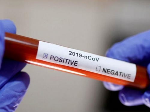 Dva nova slučaja zaraze koronavirusom u Hrvatskoj